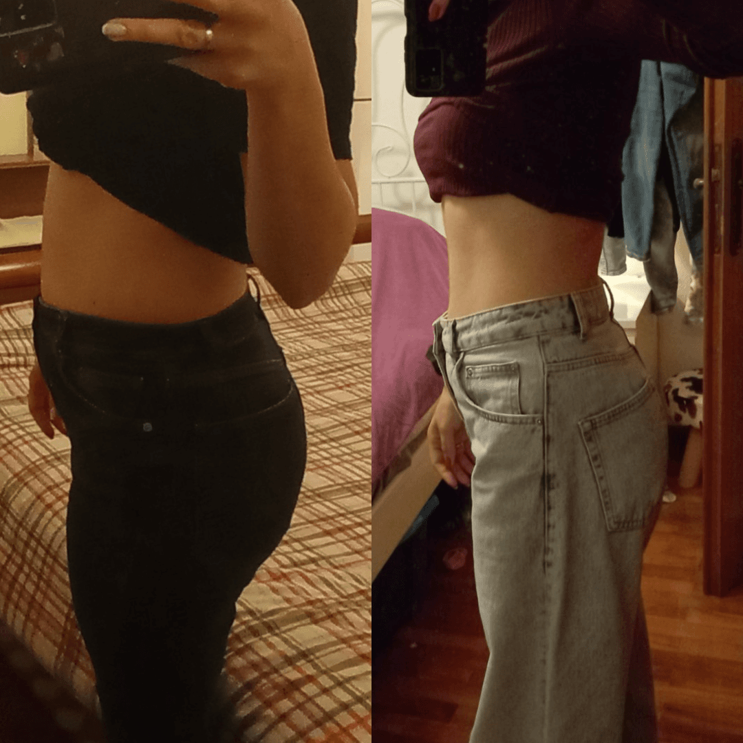Reduction of stubborn fat